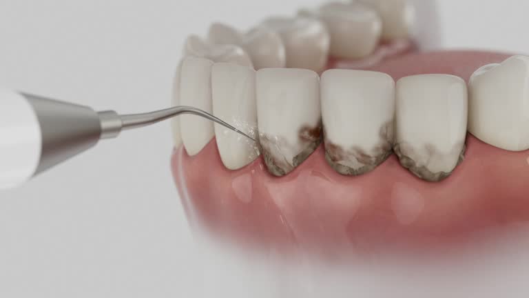 Trusted Dental Implants service in Canton, OH - Dentist Open Now